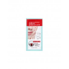 Точечные патчи-вытяжки против воспалений Holika Holika AC Mild Red Spot Patch